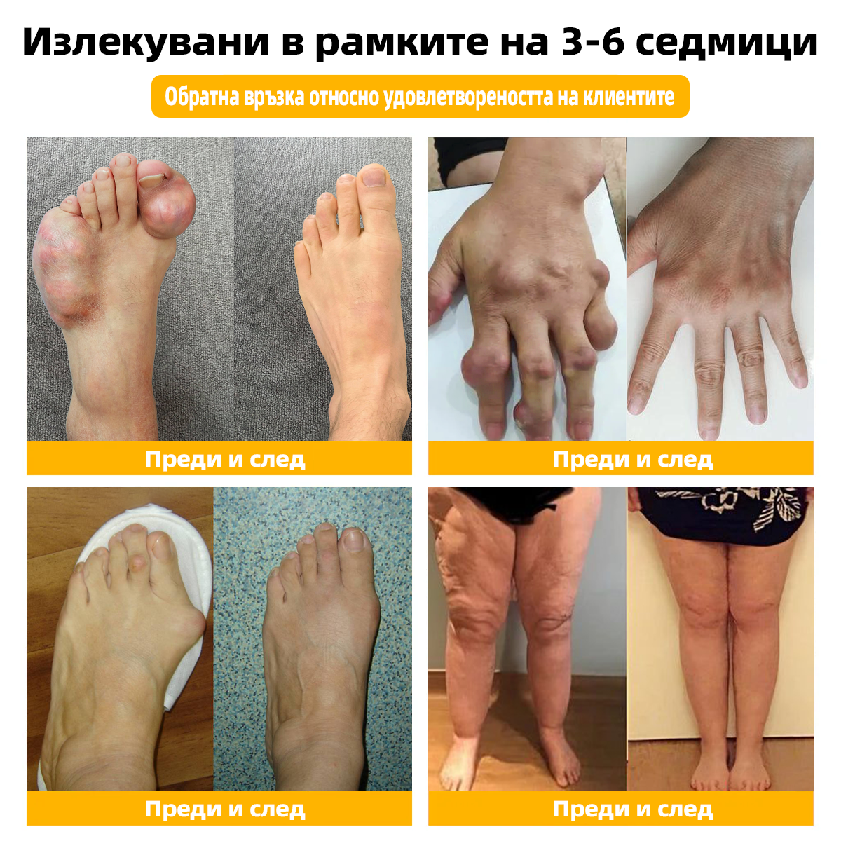 Специализира в ортопедични заболявания и болки в ставите. 👨⚕️𝐅𝐀𝐓𝐎𝐍𝐆™ Пчелна отрова & Пелин крем за стави 🍯🍯