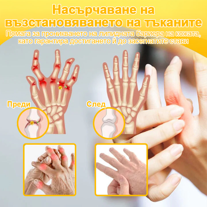 TLOPA® Ботулинов токсин и пчелна отрова Обезболяващ крем за заздравяване на кости 🐝🐝