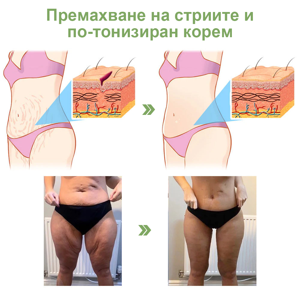 STDEI™ Луксозен Колагенов Стягащ Крем (🔥70% отстъпка за ограничено време!) 💥