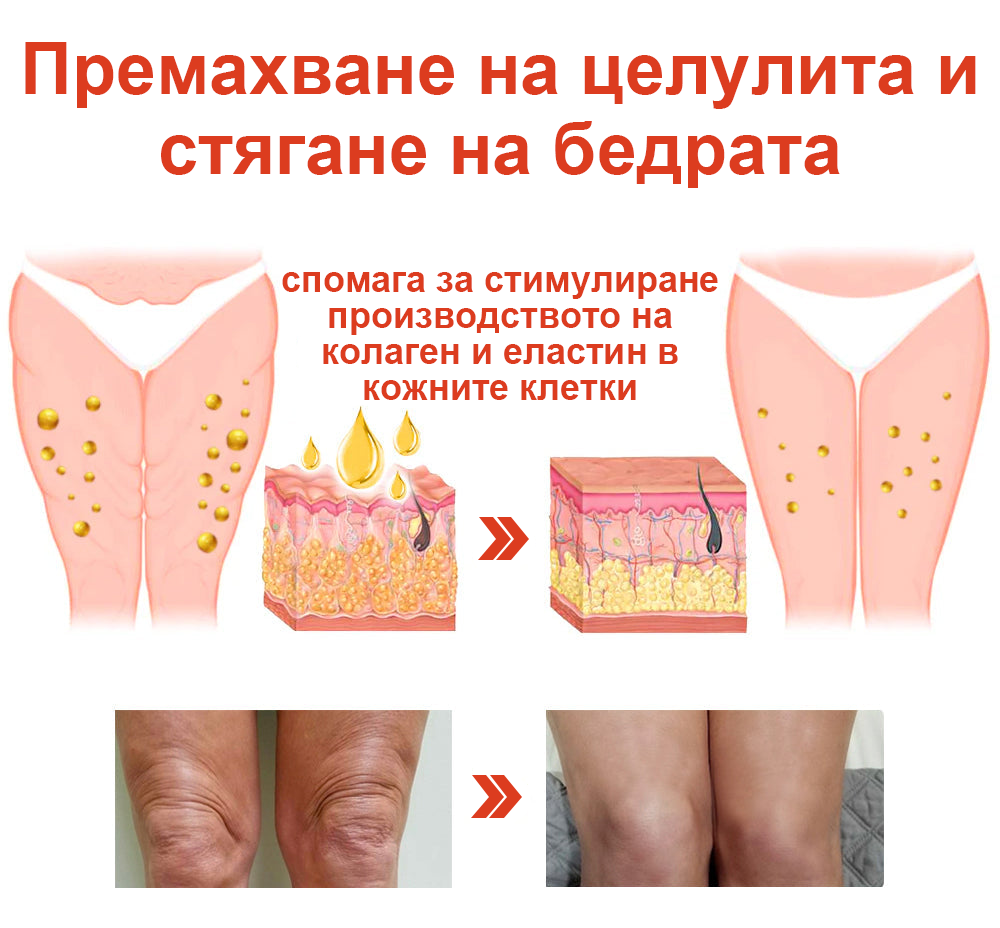 𝗦𝗧𝗗𝗘𝗜™ Магическо луксозно олио за тяло (Limited Time 80% Off - Last 30 Minutes)🌹🔥