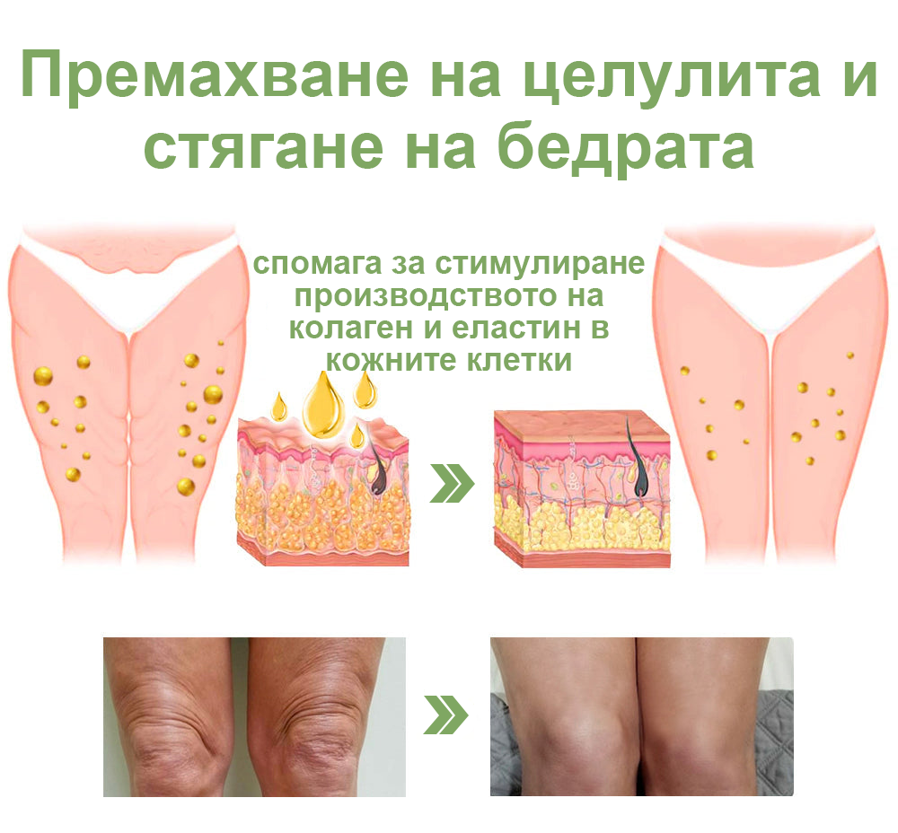 STDEI™ Луксозен Колагенов Стягащ Крем (🔥70% отстъпка за ограничено време!) 💥