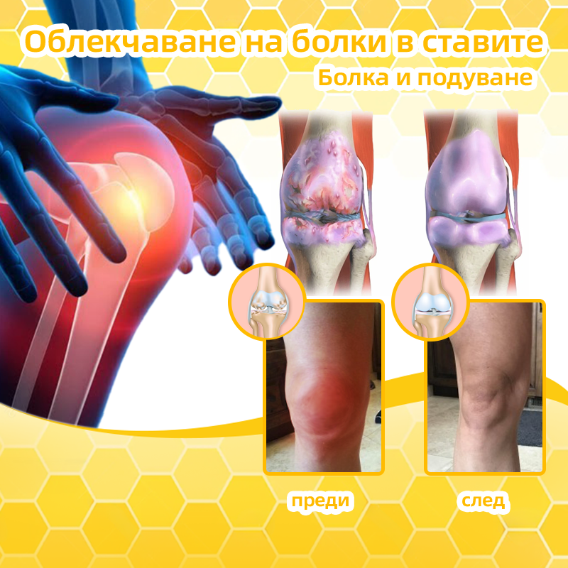 Специализира в ортопедични заболявания и болки в ставите. 👨⚕️𝐅𝐀𝐓𝐎𝐍𝐆™ Пчелна отрова & Пелин крем за стави 🍯🍯