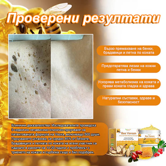 🔥Vsoxa™ Крем за премахване на брадавици и къртици с пчелна отрова (продажба в последния ден, 80% отстъпка)