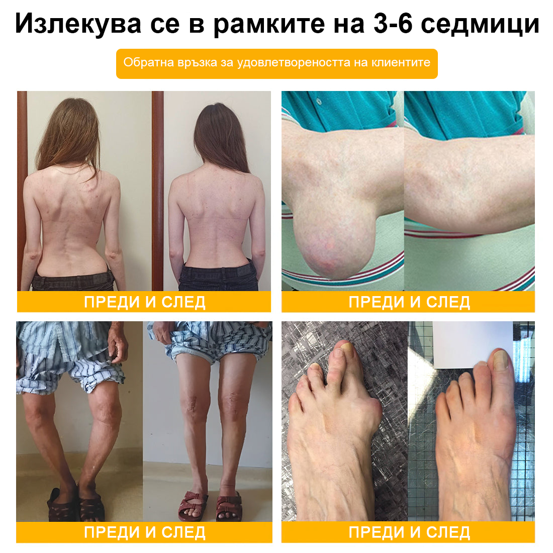 TLOPA® Ботулинов токсин и пчелна отрова Обезболяващ крем за заздравяване на кости 🐝🐝
