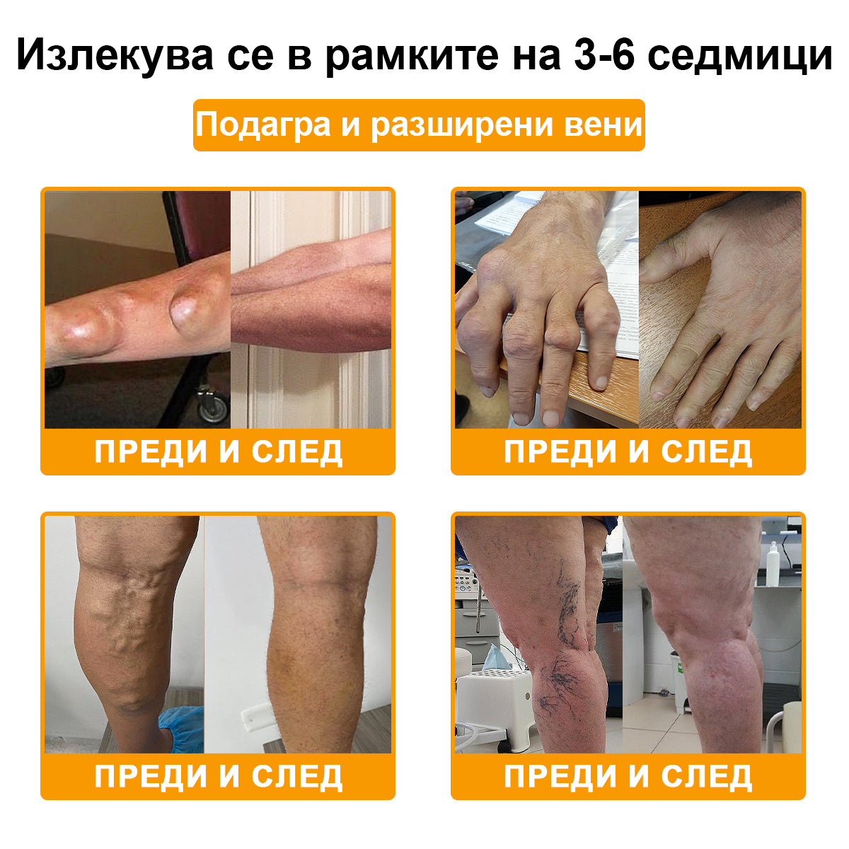 TLOPA® Ботулинов токсин и пчелна отрова Обезболяващ крем за заздравяване на кости 🐝🐝