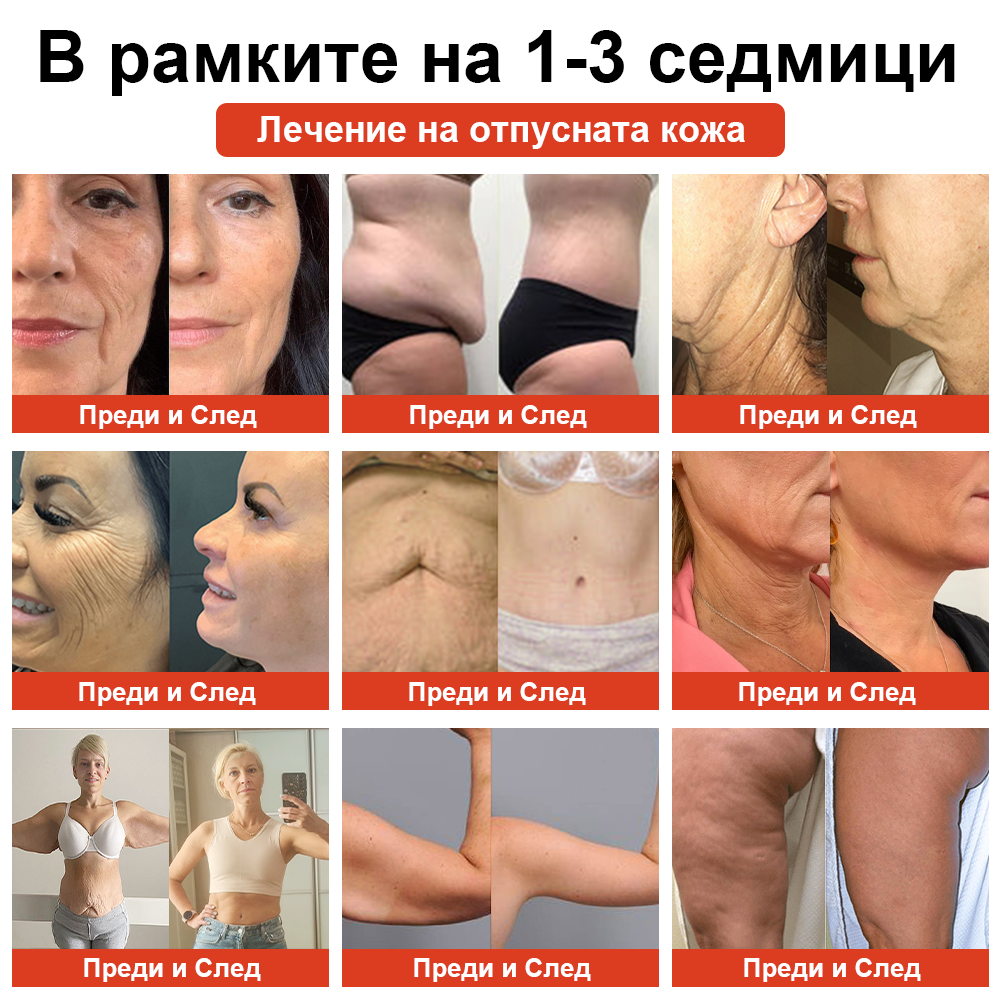 𝗦𝗧𝗗𝗘𝗜™ Магическо луксозно олио за тяло (Limited Time 80% Off - Last 30 Minutes)🌹🔥