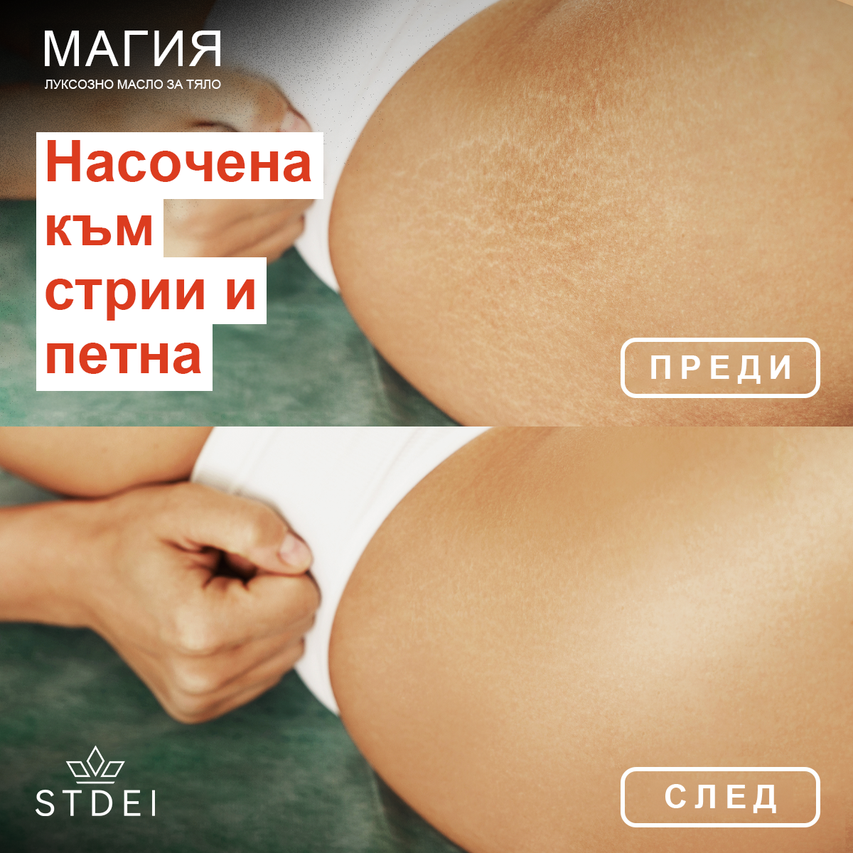 𝗦𝗧𝗗𝗘𝗜™ Магическо луксозно олио за тяло (Limited Time 80% Off - Last 30 Minutes)🌹🔥