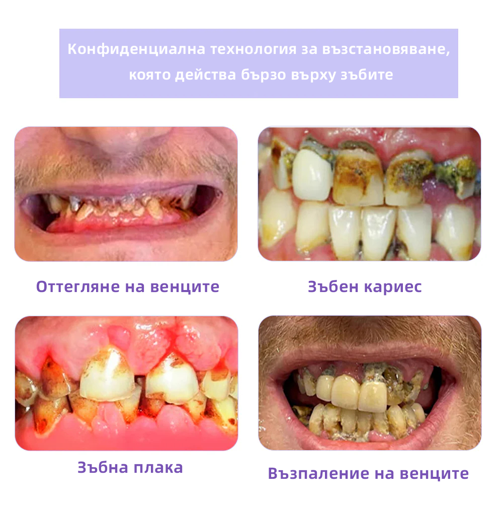 Oyikey™ Минерален прах за възстановяване на зъби🦷(BZS Препоръчано) ❤️🔥