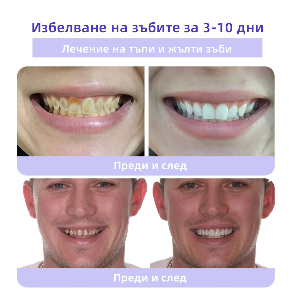 Oyikey™ Минерален прах за възстановяване на зъби🦷(BZS Препоръчано) ❤️🔥