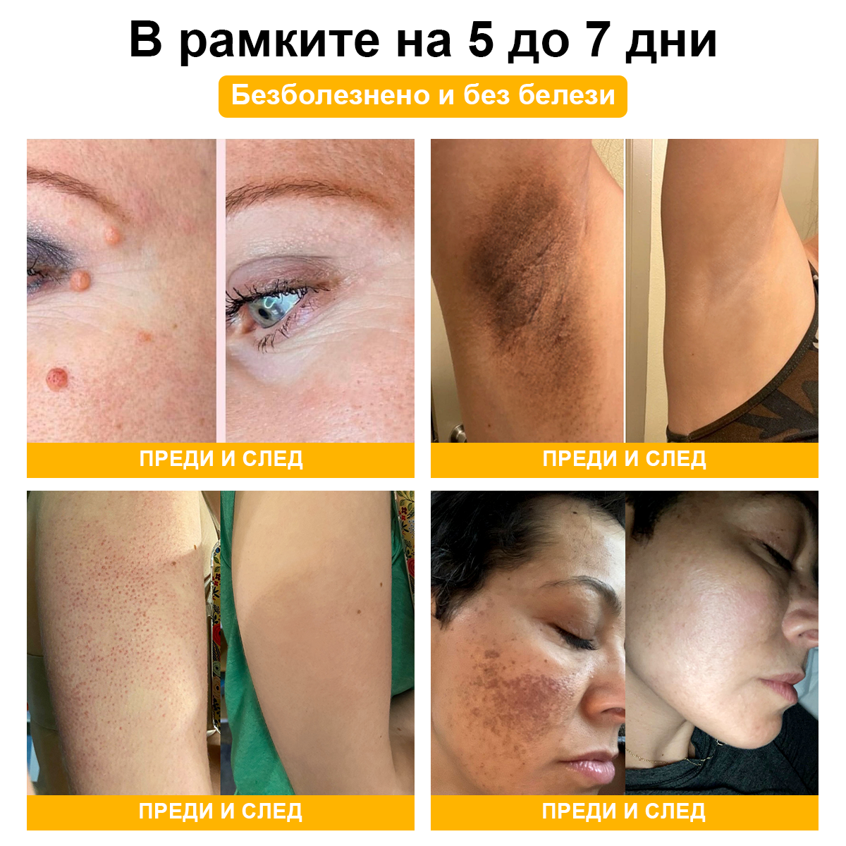 🐝✨𝑩𝑺𝑾𝑬𝑳𝑳® Крем с пчелна отрова 👨⚕️ (Препоръчано от дерматолози) (🔥Последен ден на промоцията, 80% отстъпка)