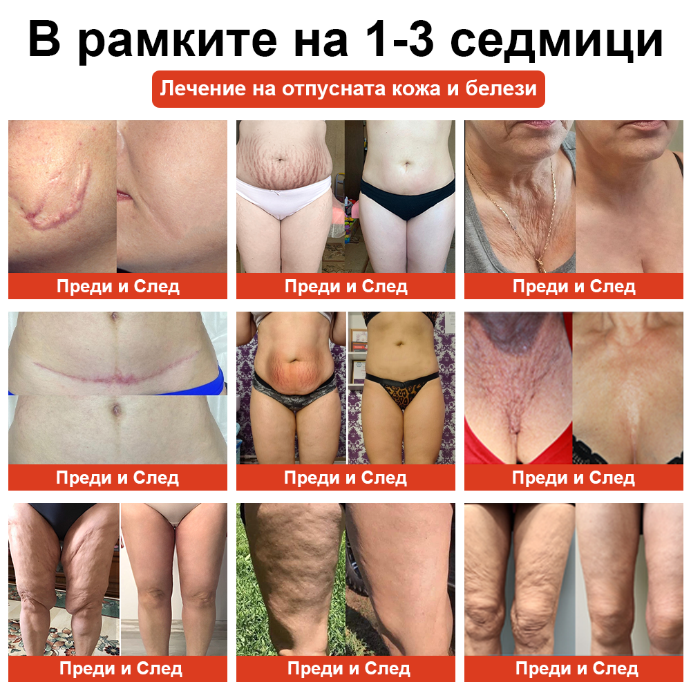 𝗦𝗧𝗗𝗘𝗜™ Магическо луксозно олио за тяло (Limited Time 80% Off - Last 30 Minutes)🌹🔥