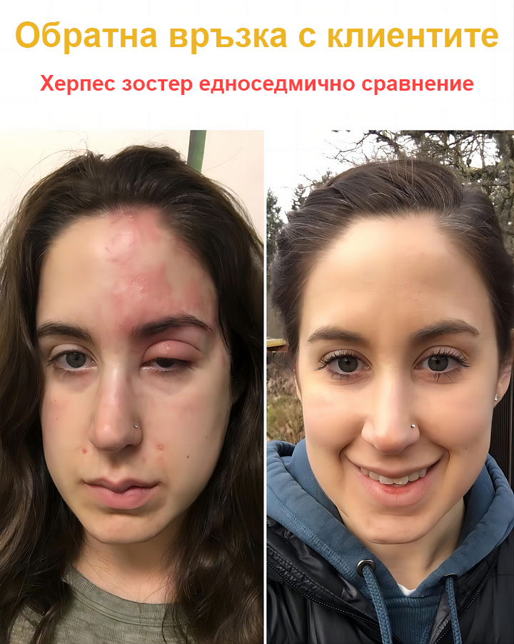 🐝✨𝑩𝑺𝑾𝑬𝑳𝑳® Крем с пчелна отрова 👨⚕️ (Препоръчано от дерматолози) (🔥Последен ден на промоцията, 80% отстъпка)