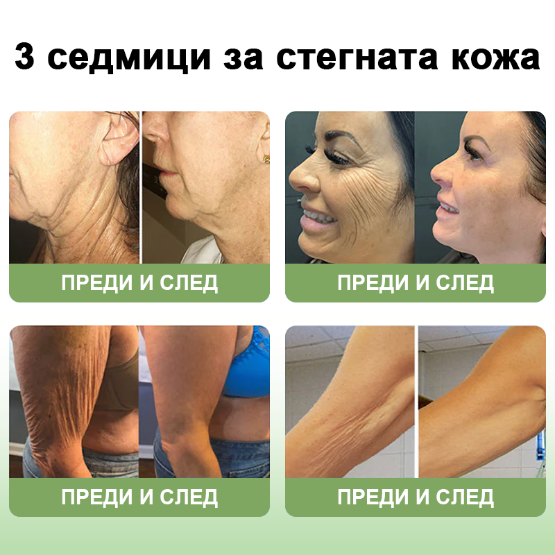STDEI™ Луксозен Колагенов Стягащ Крем (🔥70% отстъпка за ограничено време!) 💥