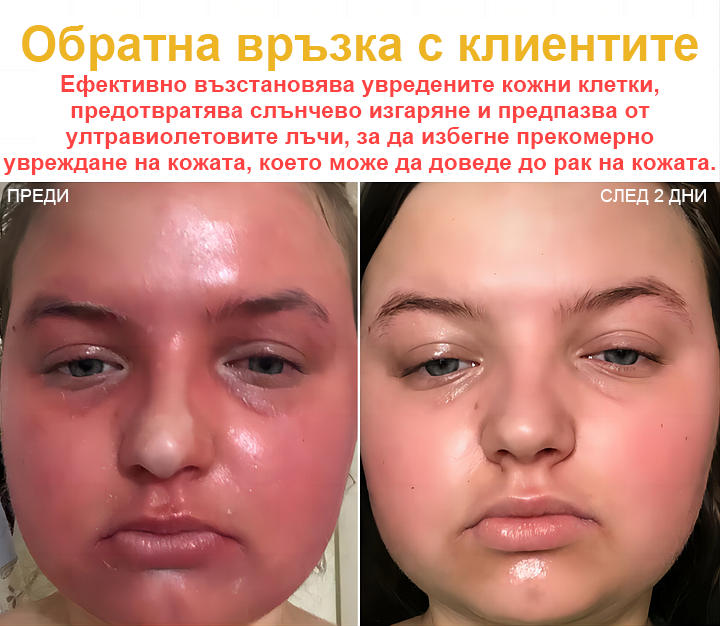 🐝✨𝑩𝑺𝑾𝑬𝑳𝑳® Крем с пчелна отрова 👨⚕️ (Препоръчано от дерматолози) (🔥Последен ден на промоцията, 80% отстъпка)
