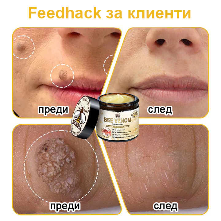 🐝✨𝑩𝑺𝑾𝑬𝑳𝑳® Крем с пчелна отрова 👨⚕️ (Препоръчано от дерматолози) (🔥Последен ден на промоцията, 80% отстъпка)