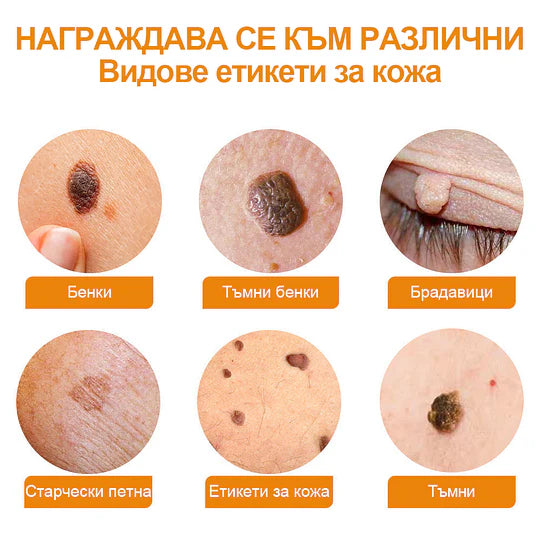 🔥Vsoxa™ Крем за премахване на брадавици и къртици с пчелна отрова (продажба в последния ден, 80% отстъпка)