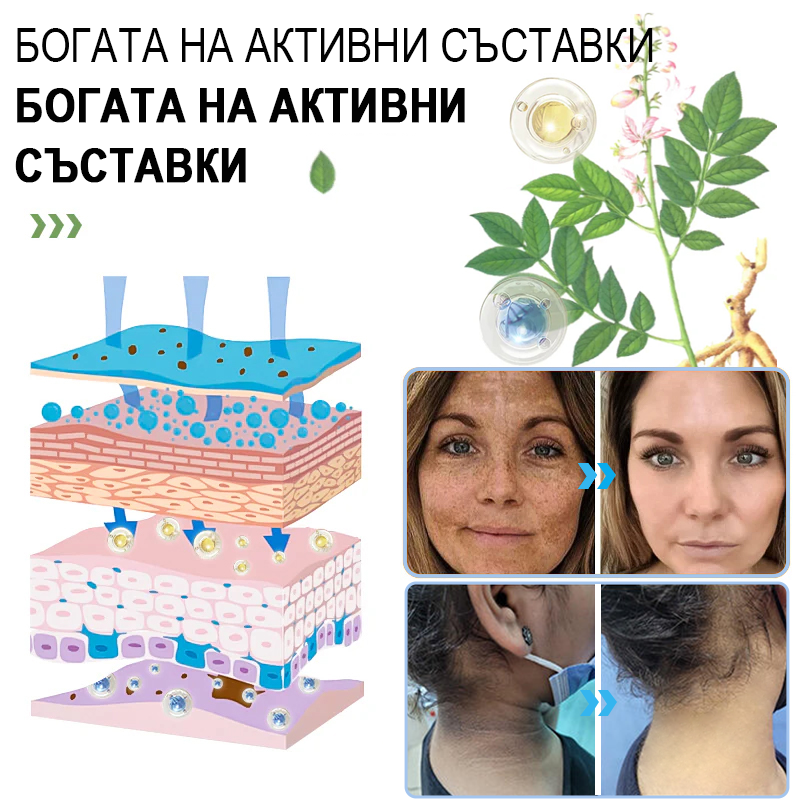 πΠΠΎΡΠΈΡΡΠ²Π°Ρ Π΅ΠΊΡΡΠΎΠ»ΠΈΡΠ°Ρ Π³Π΅Π» Π·Π° Π°ΠΊΠ°Π½ΡΠΎΠ·ΠΈΡ Π½ΠΈΠ³ΡΠΈΠΊΠ°Π½Ρ, Π΅ΠΊΡΡΠΎΠ»ΠΈΠ°ΡΠΈΡ, ΡΡΠΌΠ½ΠΈ ΠΏΠ΅ΡΠ½Π°, ΠΊΠΎΠΆΠ½ΠΈ Π΅ΡΠΈΠΊΠ΅ΡΠΈ ΠΈ Π΅ΠΊΠ·Π΅ΠΌΠ°