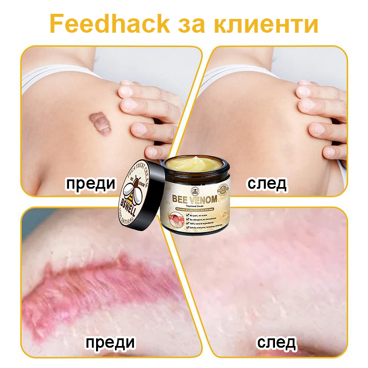 🐝✨𝑩𝑺𝑾𝑬𝑳𝑳® Крем с пчелна отрова 👨⚕️ (Препоръчано от дерматолози) (🔥Последен ден на промоцията, 80% отстъпка)