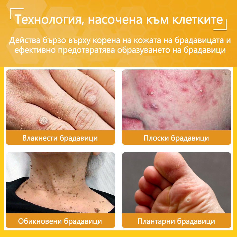 ✅flysmus® Силен крем с пчелен отров – ✨Препоръчван от експерти по дерматология. Ефективен срещу брадавици, издутини, лезии, инфекции и белези.🐝
