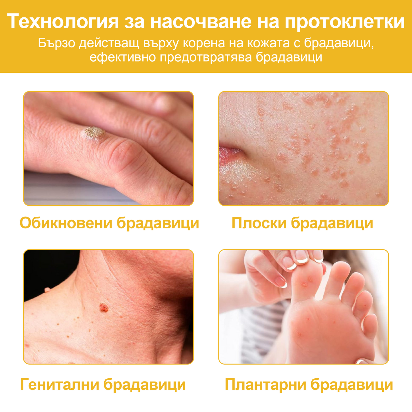 🐝✨𝑩𝑺𝑾𝑬𝑳𝑳® Крем с пчелна отрова 👨⚕️ (Препоръчано от дерматолози) (🔥Последен ден на промоцията, 80% отстъпка)