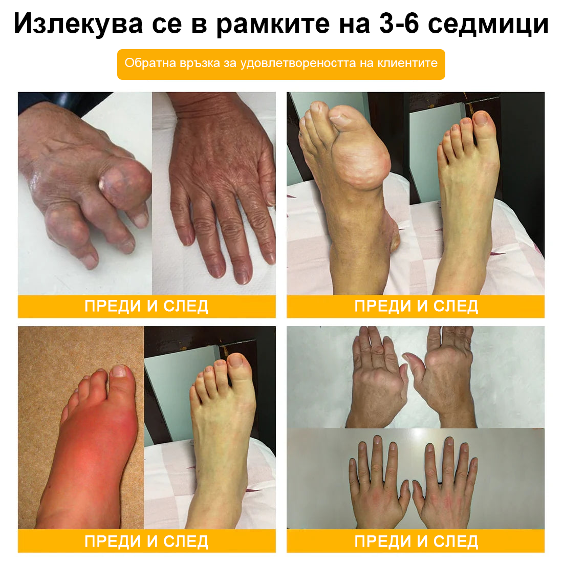 TLOPA® Ботулинов токсин и пчелна отрова Обезболяващ крем за заздравяване на кости 🐝🐝