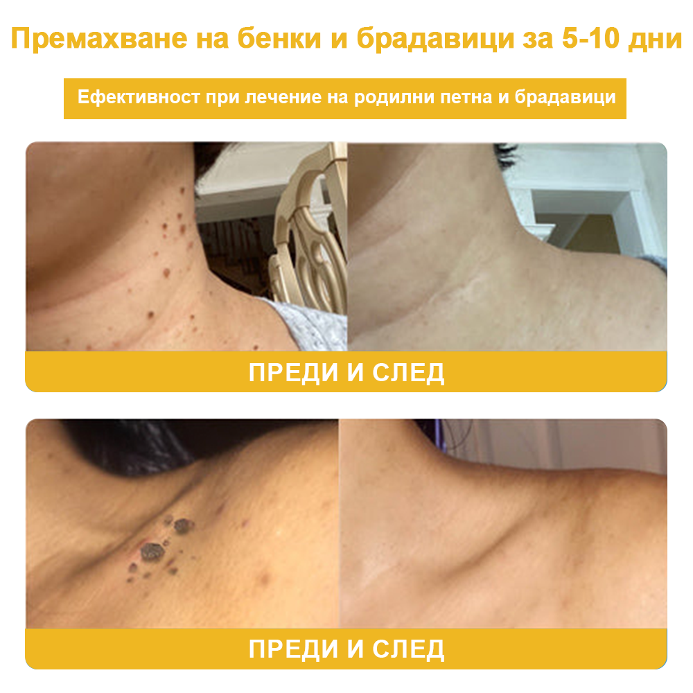 🐝✨𝑩𝑺𝑾𝑬𝑳𝑳® Крем с пчелна отрова 👨⚕️ (Препоръчано от дерматолози) (🔥Последен ден на промоцията, 80% отстъпка)
