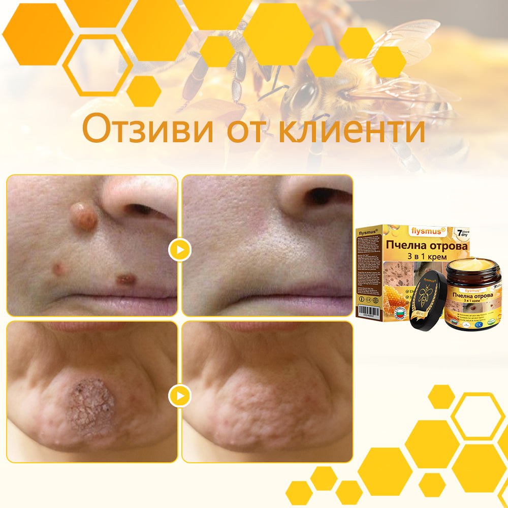 ✅flysmus® Силен крем с пчелен отров – ✨Препоръчван от експерти по дерматология. Ефективен срещу брадавици, издутини, лезии, инфекции и белези.🐝