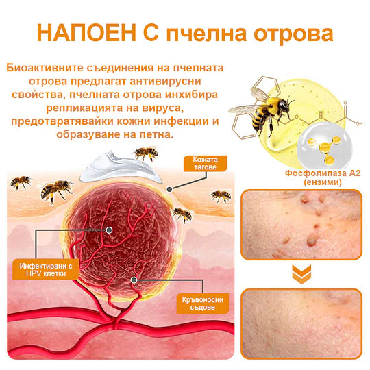 🔥Vsoxa™ Крем за премахване на брадавици и къртици с пчелна отрова (продажба в последния ден, 80% отстъпка)