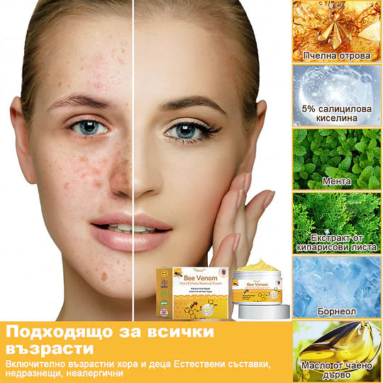 🔥Vsoxa™ Крем за премахване на брадавици и къртици с пчелна отрова (продажба в последния ден, 80% отстъпка)