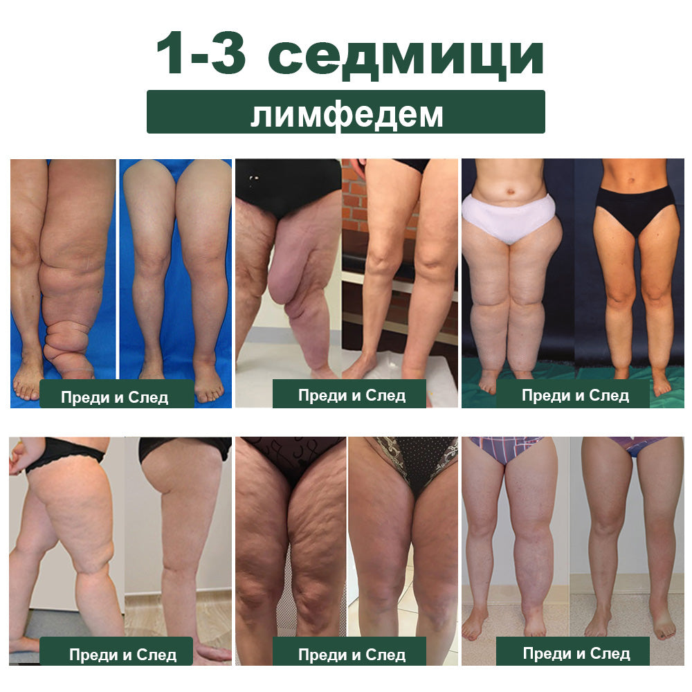 𝐁𝐞𝐧𝐞𝐭𝐮𝐫𝐞™ пчелна отрова за отслабване лимфен детоксикиращ крак топки 🫚-- Препоръчано от клиника Мейо