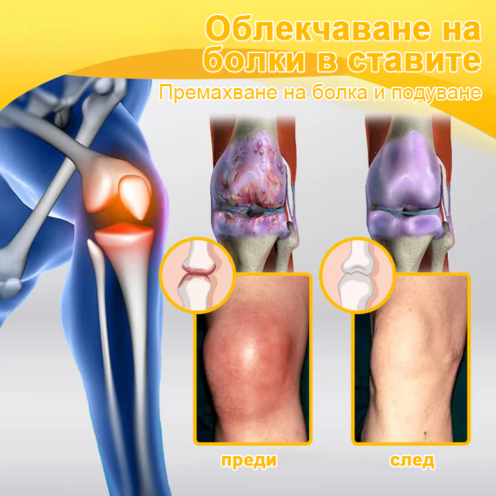 ✅TLOPA® Ботулинов токсин и пчелна отрова Обезболяващ крем за заздравяване на кости 🐝