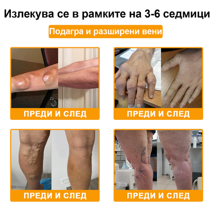 ✅TLOPA® Ботулинов токсин и пчелна отрова Обезболяващ крем за заздравяване на кости 🐝