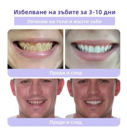 Oyikey™ Минерален прах за възстановяване на зъби🦷(BZS Препоръчано) ❤️‍🔥