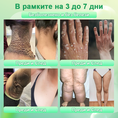 🍇Почистващ ексфолиращ гел за акантозис нигриканс, ексфолиация, тъмни петна, кожни етикети и екзема