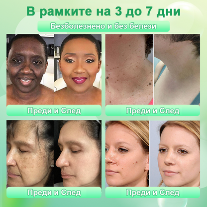 🍇Почистващ ексфолиращ гел за акантозис нигриканс, ексфолиация, тъмни петна, кожни етикети и екзема