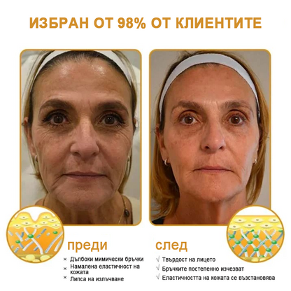 Последен промоционален ден: 70% отстъпка - ✨Furzero™ крем за премахване на бръчки с пчелна отрова Botox
