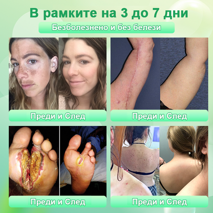 🍇Почистващ ексфолиращ гел за акантозис нигриканс, ексфолиация, тъмни петна, кожни етикети и екзема