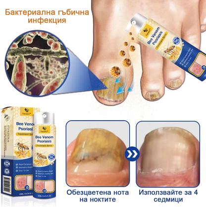 👨‍⚕Furzero™ Спрей за лечение на псориазис за намаляване на сърбежа и възпалението след 2 седмици. (Д-р Каройи Кристина: достоверна препоръка)
