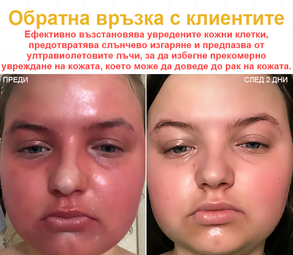 🐝✨𝑩𝑺𝑾𝑬𝑳𝑳® Крем с пчелна отрова 👨‍⚕️ (Препоръчано от дерматолози) (🔥Последен ден на промоцията, 80% отстъпка)