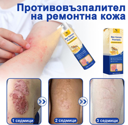👨‍⚕Furzero™ Спрей за лечение на псориазис за намаляване на сърбежа и възпалението след 2 седмици. (Д-р Каройи Кристина: достоверна препоръка)