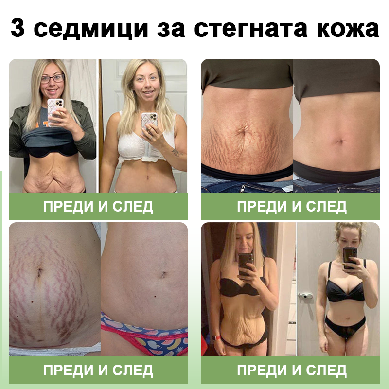 STDEI™ Луксозен Колагенов Стягащ Крем (🔥70% отстъпка за ограничено време!) 💥