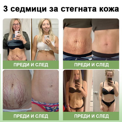 STDEI™ Луксозен Колагенов Стягащ Крем (🔥70% отстъпка за ограничено време!) 💥