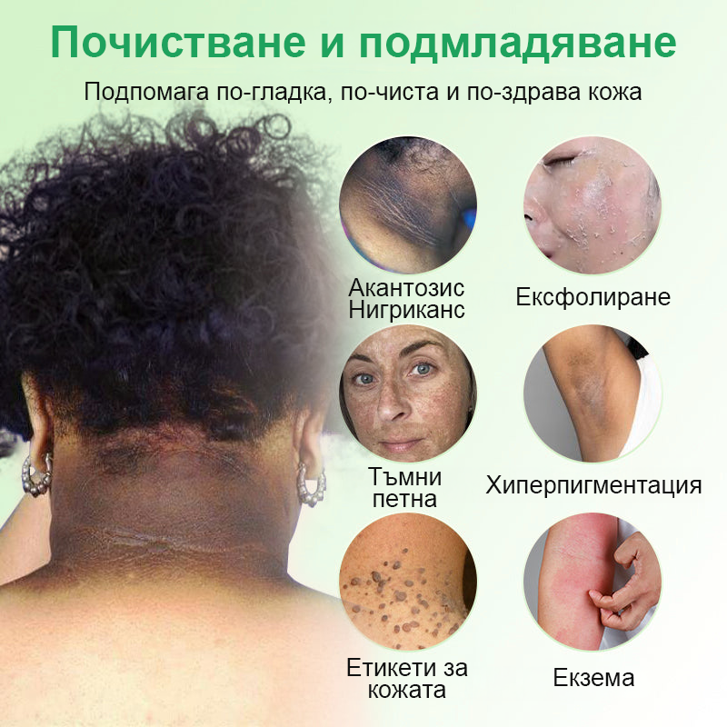 🍇Почистващ ексфолиращ гел за акантозис нигриканс, ексфолиация, тъмни петна, кожни етикети и екзема