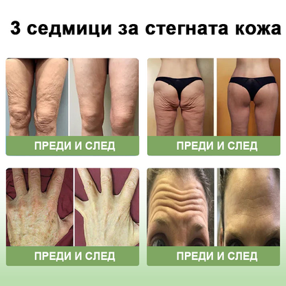 STDEI™ Луксозен Колагенов Стягащ Крем (🔥70% отстъпка за ограничено време!) 💥