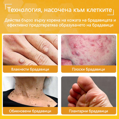 ✅flysmus® Силен крем с пчелен отров – ✨Препоръчван от експерти по дерматология. Ефективен срещу брадавици, издутини, лезии, инфекции и белези.🐝
