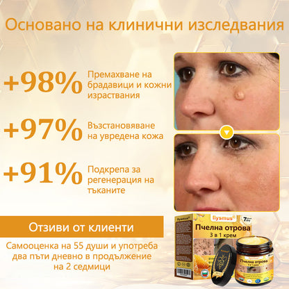 ✅flysmus® Силен крем с пчелен отров – ✨Препоръчван от експерти по дерматология. Ефективен срещу брадавици, издутини, лезии, инфекции и белези.🐝