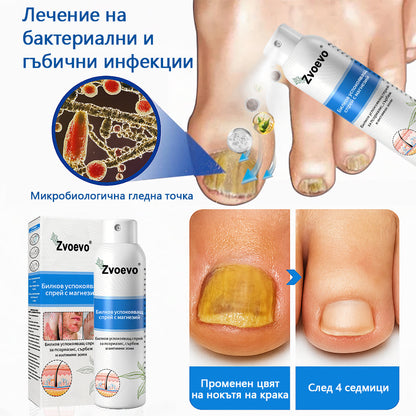 Официален магазин✨: Zvoevo® Магнезиев билков спрей за псориазис⚕️Сертифициран от FDA (облекчаване на псориазис и екзема, подобряване на бактериални инфекции в гениталната област и лечение на акне и тъмни петна)