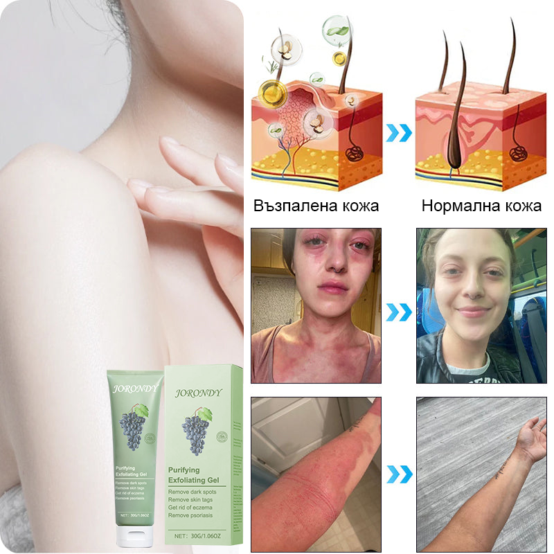 🍇Почистващ ексфолиращ гел за акантозис нигриканс, ексфолиация, тъмни петна, кожни етикети и екзема