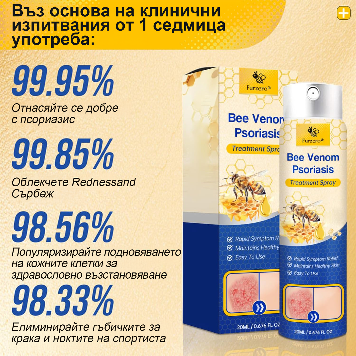 👨‍⚕Furzero™ Спрей за лечение на псориазис за намаляване на сърбежа и възпалението след 2 седмици. (Д-р Каройи Кристина: достоверна препоръка)