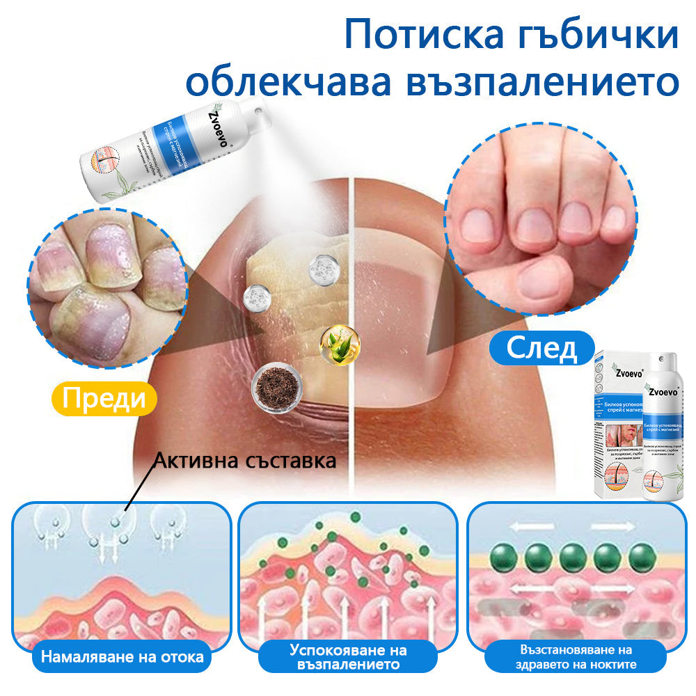 Официален магазин✨: Zvoevo® Магнезиев билков спрей за псориазис⚕️Сертифициран от FDA (облекчаване на псориазис и екзема, подобряване на бактериални инфекции в гениталната област и лечение на акне и тъмни петна)